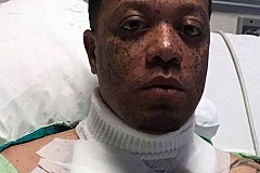 Etats-Unis: Un homme électrocuté dans son lit par son chargeur d'iPhone (vidéo) Etats-Unis: Un homme électrocuté dans son lit par son chargeur d'iPhone (vidéo)